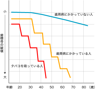 タバコの歯槽骨破壊の関係