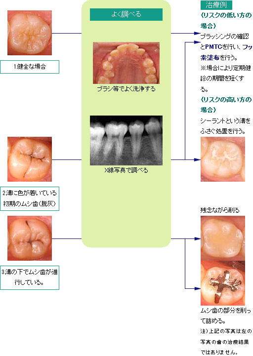 治療の要否判定