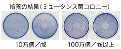 ミュータンス菌培養の結果