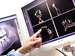 歯科用3D／X線　CT撮影装置