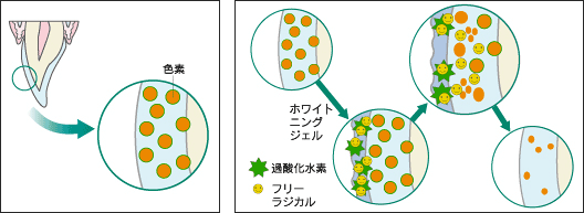 ホワイトニングのメカニズム